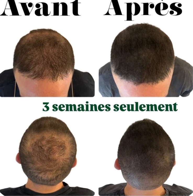 Résultat micropigmentation — look soigné