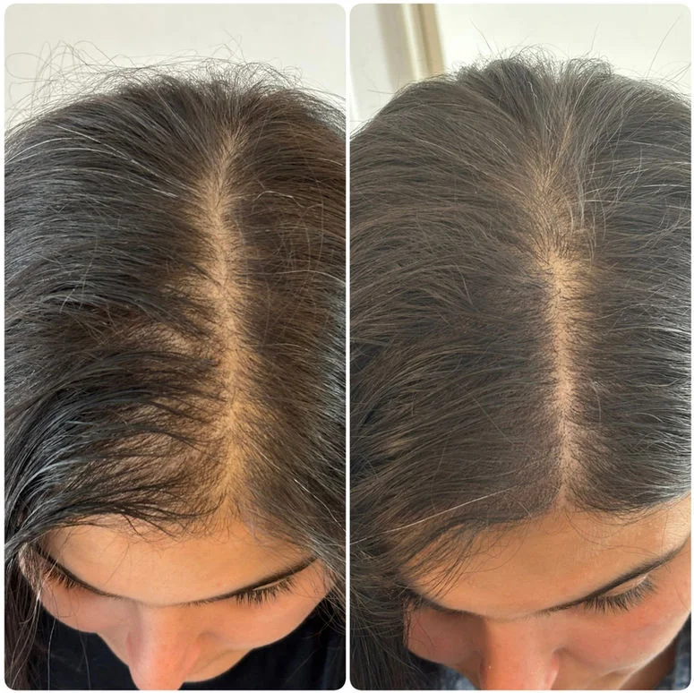 Résultat micropigmentation femme